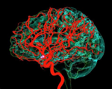 Arterioles are small, nearly microscopic blood vessels that branch from muscular arteries. Blood Vessels Supplying The Brain Photograph by K H Fung/science Photo Library