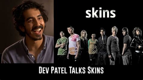 Dev Patel On Skins And How It Shaped His Career Youtube