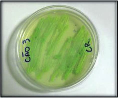 Yeasts Of Genus Candida On Chromagar Candida Candida Albicans With