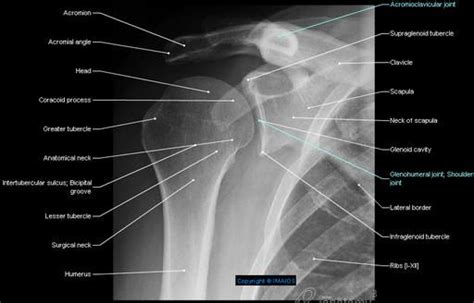 Anatomy Of Radiograph Of Upper Limb View Shoulder Radiology