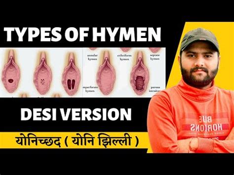 Types Of Hymen Clitoris Female Vulva
