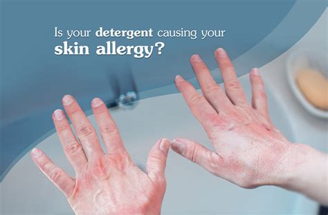 Is Your Detergent Causing Your Skin Allergy