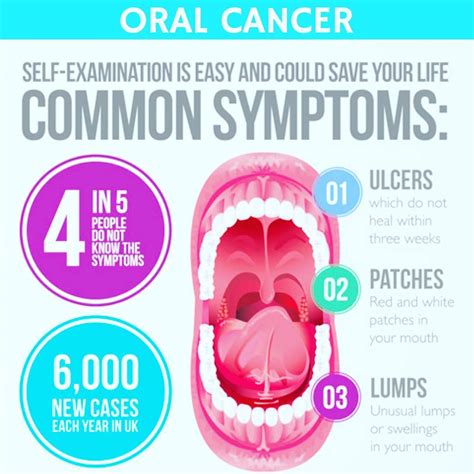Diy Guide For Checking For Mouth Or Oral Cancer Thailand Medical News