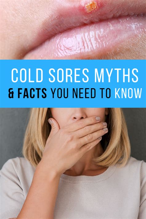 They are the tingling stage, the blister stage, the weeping stage, the scabbing stage and the healing ** during this stage, an individual can feel a tingling sensation where the cold sore is beginning to form. Pin on Cold sores ARE herpes, but NP if...