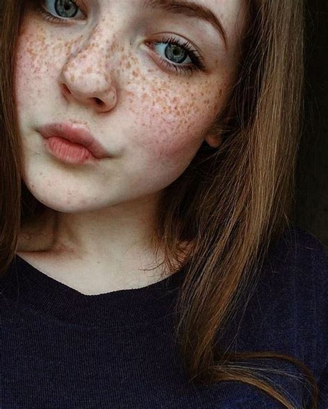 A Girl With Freckles On Her Face Looking At The Camera