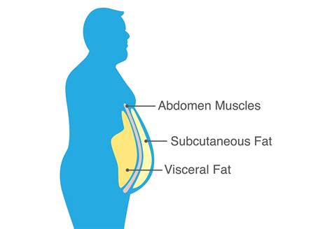 What Causes Visceral Fat Addressing Symptoms