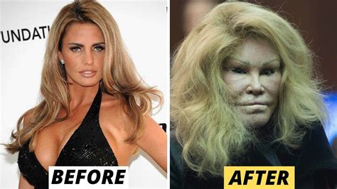15 Celebrity Plastic Surgery Disasters YouTube In 2022 Bad