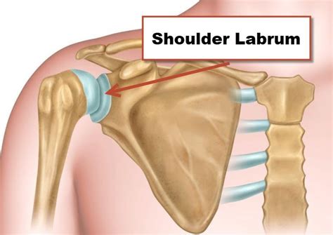 Shoulder Labral Tear Motus Physical Therapy