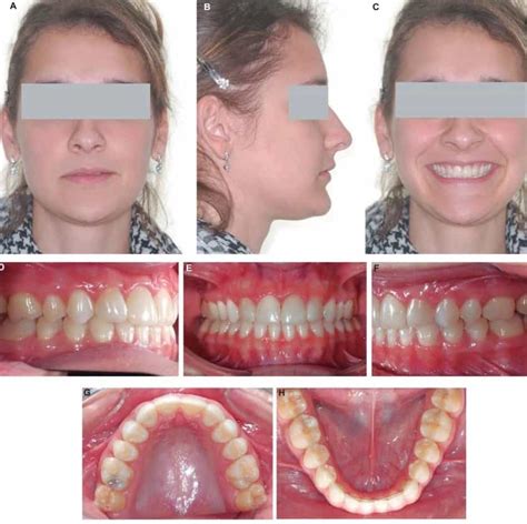 What Are Orthodontic Photographs Archwired