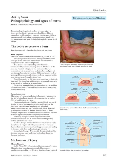 Pdf Abc Of Burns Pathophysiology And Types Of Burns