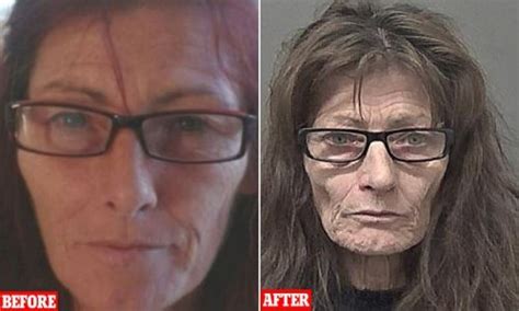 shocking pictures show effects of class a drugs on frail 53 year old