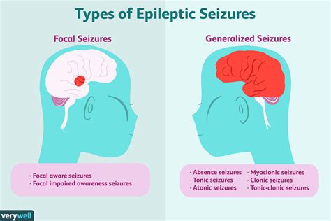 Epilepsy Overview And More
