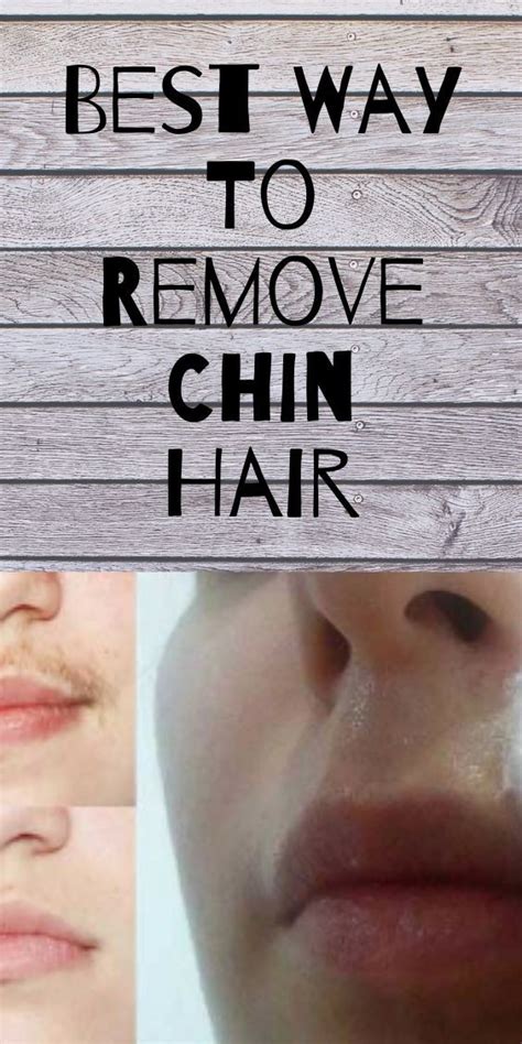 White Chin Hair Chin Hair Chin Natural Hair Removal