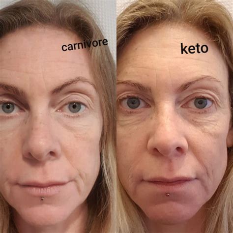Unless you’re a child, you’ve probably heard cautionary tales from your doctor about the dangers of high cholesterol. carnivore diet success story transformation with Tani