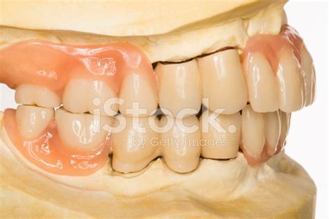 Denture Stock Photo Royalty Free Freeimages