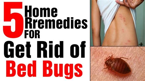 5 Effective Home Remedies To Get Rid Of Bed Bugs Youtube