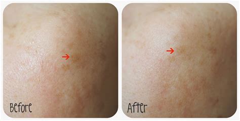 Palmer's face oil moisturises your skin, but the feel is entirely different from a cream moisturiser. Palmer's Skin Therapy Oil - Popiah's