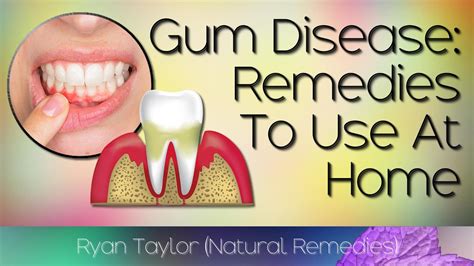 Natural Remedies For Gum Disease Home Treatment Youtube