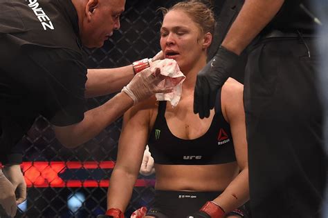 Sad Ronda Rousey Reveals Mouth Injury Unstable Teeth May Keep Her Shelved And Apple Free