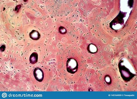 The osteon consists of a central canal called the osteonic (haversian) canal, which is surrounded by concentric rings (lamellae) of matrix. Histology Of Human Compact Bone Tissue Under Microscope ...