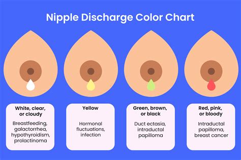 Nipple Discharge Causes Symptoms And Treatment