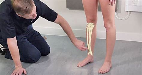 Shin Splints Taping Video Tutorial Instant Relief For Shin Pain