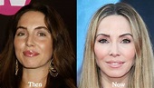 Whitney Cummings Plastic Surgery: Nose Job, Facelift, Eyelid Surgical