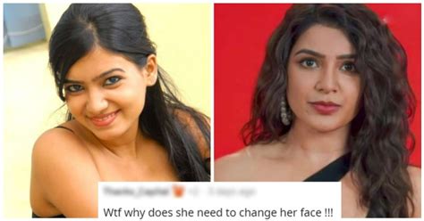Samantha Trolled For Allegedly Getting A Nose Job And A Lip Job Done