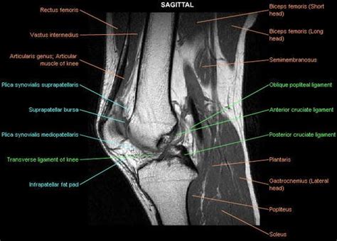 Scroll through the structures to understand the anatomy. Knee Imaging - Knee & Sports - Orthobullets