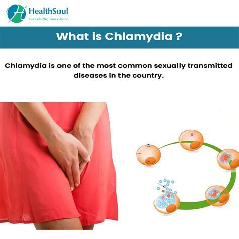 Understanding Chlamydia Symptoms Risks And Treatment Options