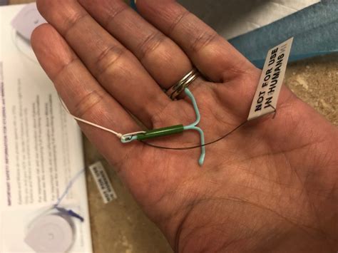 My Iud Almost Killed Me What You Should Know Before Placement Day