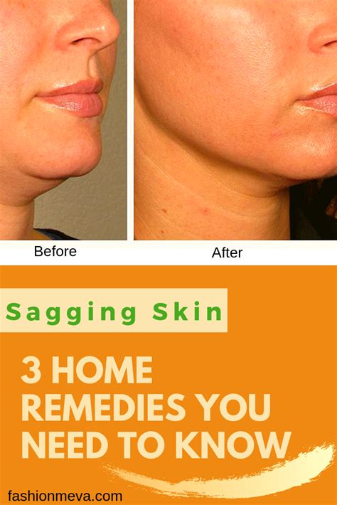Sagging Skin 3 Home Remedies You Need To Know