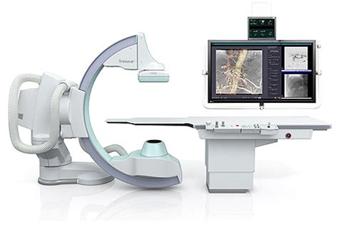 My minxray hf80 has been dropped, kicked, stepped on, in two car accidents, used in. BIOMEDICAL ENGINEERING: Digital subtraction angiography