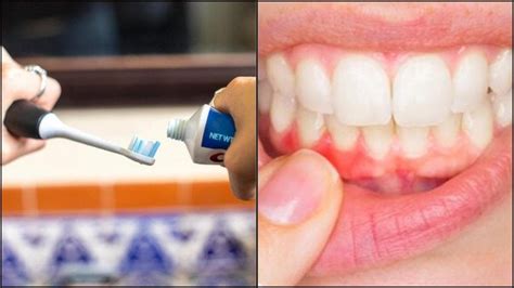 Myths Busted About Dental Hygiene That Are Sure To Up Your Oral