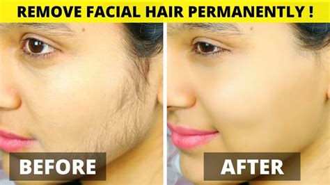 how to remove facial hair permanently at home in one day youtube