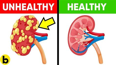 13 Foods That Make Your Kidneys Healthy Youtube Cancer Prevention