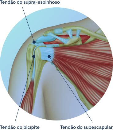 Tendinites Do Supra Espinhoso Cl Nica Do Joelho E Ombro Prof