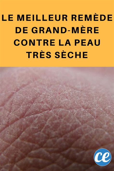 Le Meilleur Rem De De Grand M Re Contre La Peau Tr S S Che Recette