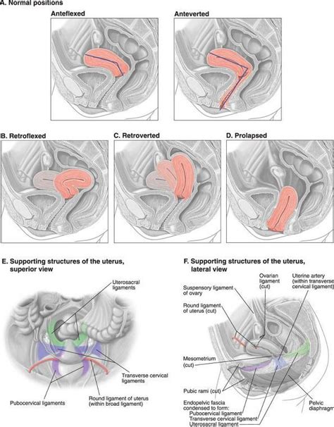 positions of the uterus obstetric ultrasound ultrasound sonography retroverted uterus