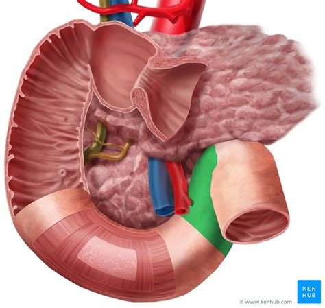 Duplication Of Duodenum Clinical Case And Cadaver Images Kenhub