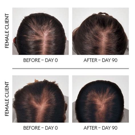 Reactional Thinning Hair Routine