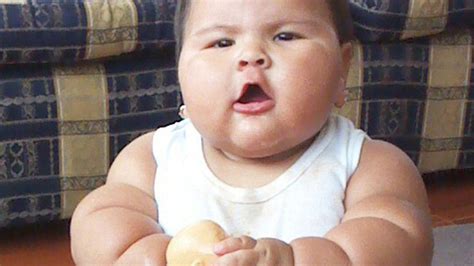 Obese Baby With Mystery Illness Weighs 20kgs At Just 10 Months Old