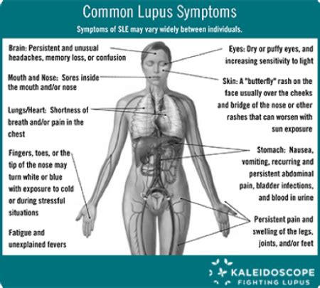 Common Lupus Symptoms Kaleidoscope Fighting Lupus