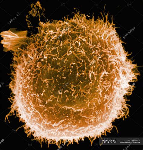 Scanning Electron Micrograph Of Human Macrophage — Biological White