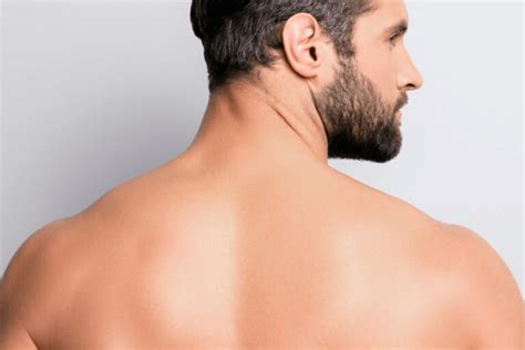 Male Back Hair Removal Calveo Laser Hair Removal And Beauty Oakham Rutland