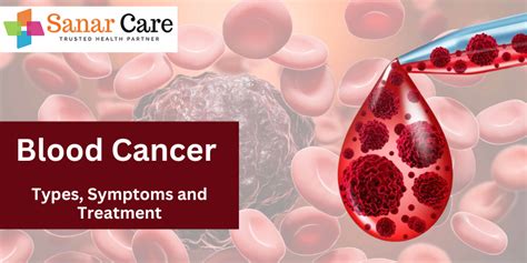 Blood Cancer Types Symptoms And Treatment Sanar Care