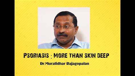 Psoriasis More Than Skin Deep Dr Murlidhar Rajagopalan Youtube