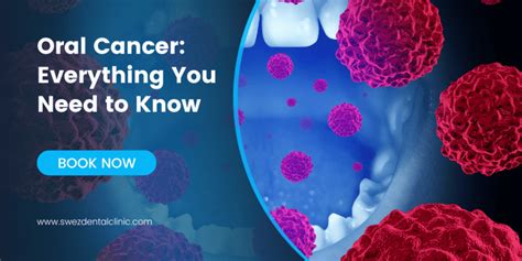 Oral Cancer Everything You Need To Know