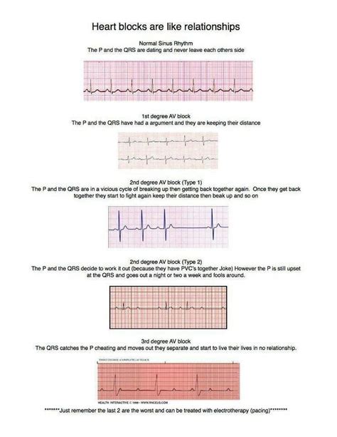 Dysrhythmia Cheat Sheet