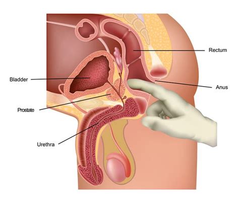 Prostate Milking Procedure Cumception